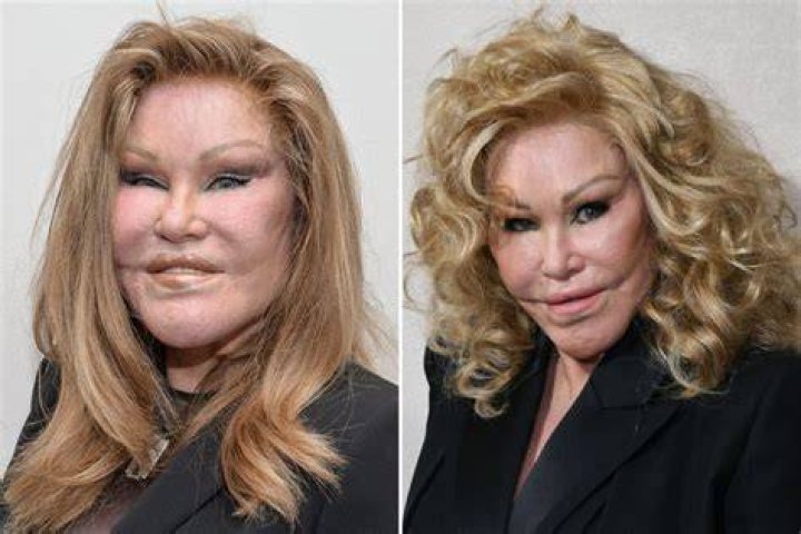 Unveiling The Enigma Of "Catwoman Wildenstein": Discoveries And Insights